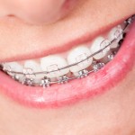 marcysiowy zabek roselle dentist