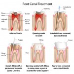 marcysiowy zabek roselle dentist